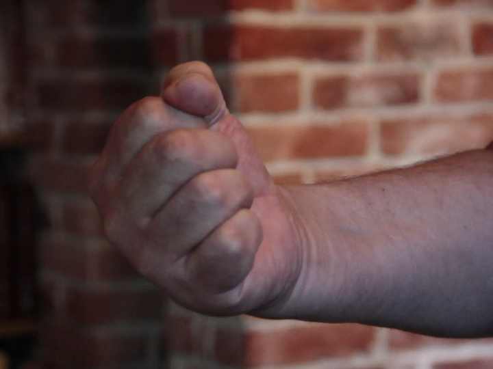 Из-за «пропажи» телефона калининградец сломал ребра 56-летнему мужчине